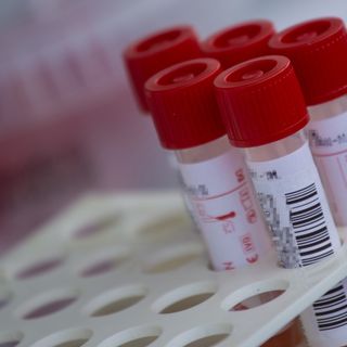 Oggi in provincia di Cuneo 165 positivi e 18 guariti. In Piemonte i ricoveri superano quota 700 (+63)