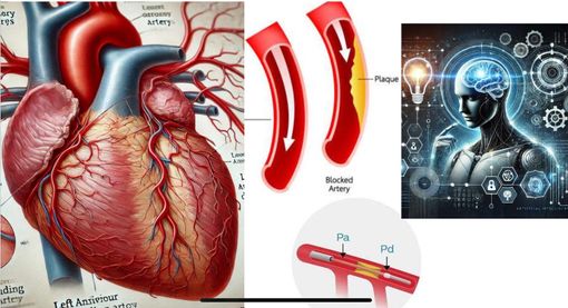 Quando fare l’angioplastica coronarica? Ora lo dice l’Intelligenza Artificiale