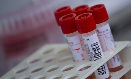 Oggi in provincia di Cuneo 165 positivi e 18 guariti. In Piemonte i ricoveri superano quota 700 (+63) Oggi in provincia di Cuneo 165 positivi e 18 guariti. In Piemonte i ricoveri superano quota 700 (+63)