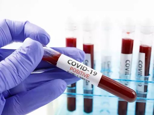 Covid, in Piemonte il virus corre meno che nelle altre regioni. Oltre 160 mila le quarte dosi somministrate Covid, in Piemonte il virus corre meno che nelle altre regioni. Oltre 160 mila le quarte dosi somministrate