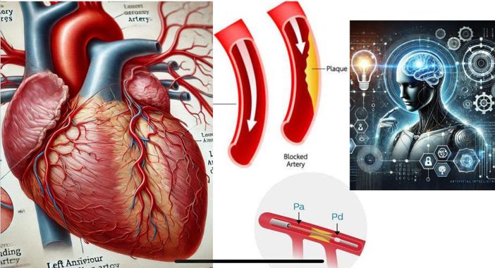 Quando fare l’angioplastica coronarica? Ora lo dice l’Intelligenza Artificiale