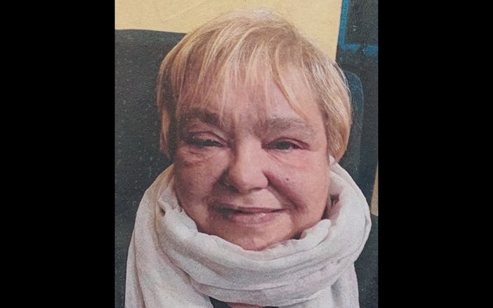 Giovanna Chiappa, 59 anni Giovanna Chiappa, 59 anni