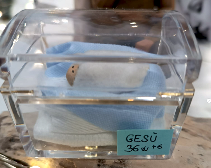 Al Santa Croce lo speciale presepe della Terapia Intensiva Neonatale: "Da noi è già nato"