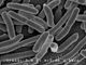 E. Coli Bacteria - Credit: NIAID E. Coli Bacteria - Credit: NIAID