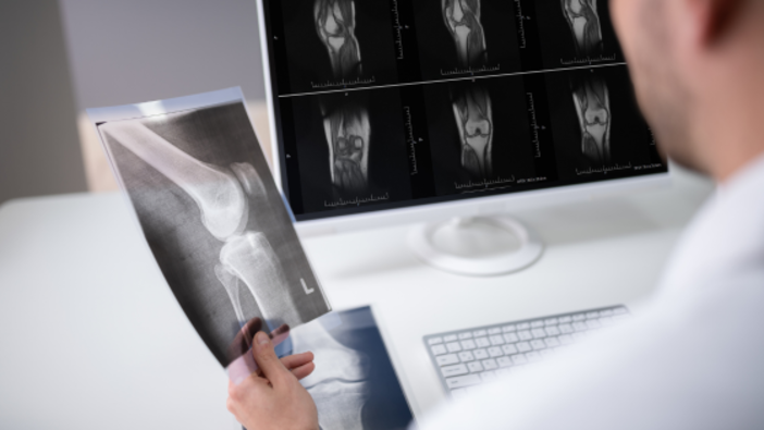 Referti radiologici online da oggi per gli utenti dell'Asl Cn2: immagini e documenti scaricabili da remoto Referti radiologici online da oggi per gli utenti dell'Asl Cn2: immagini e documenti scaricabili da remoto