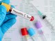 Giornata mondiale dell'epatite: in Piemonte screening gratuiti per eliminare il virus entro il 2030 Giornata mondiale dell'epatite: in Piemonte screening gratuiti per eliminare il virus entro il 2030