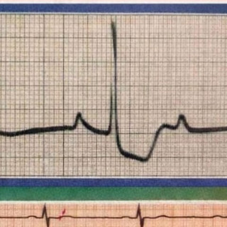 Alba: elettrocardiogrammi gratuiti per tutti grazie alla Croce Rossa