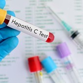 Giornata mondiale dell'epatite: in Piemonte screening gratuiti per eliminare il virus entro il 2030 Giornata mondiale dell'epatite: in Piemonte screening gratuiti per eliminare il virus entro il 2030