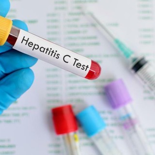 Giornata mondiale dell'epatite: in Piemonte screening gratuiti per eliminare il virus entro il 2030 Giornata mondiale dell'epatite: in Piemonte screening gratuiti per eliminare il virus entro il 2030