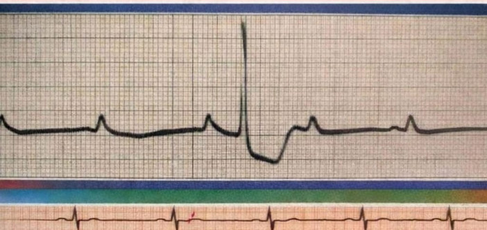 Alba: elettrocardiogrammi gratuiti per tutti grazie alla Croce Rossa