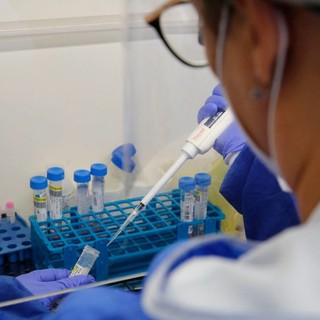 Hantavirus, inviate le indicazioni di sanità pubblica a ospedali e medici. Ma non c'è alcun allarme Hantavirus, inviate le indicazioni di sanità pubblica a ospedali e medici. Ma non c'è alcun allarme