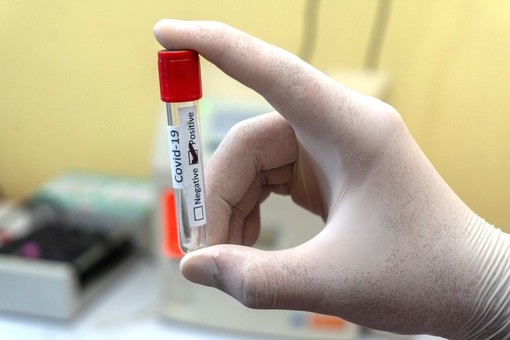 Coronavirus, in Piemonte 376 nuovi casi, ma calano i ricoveri in terapia intensiva