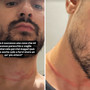 Mr. Daniel, il make-up artist dei vip, aggredito e rapinato a Milano: il racconto choc sui social Mr. Daniel, il make-up artist dei vip, aggredito e rapinato a Milano: il racconto choc sui social