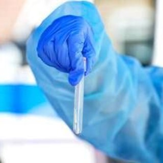 Hantavirus, il punto: contagio e sintomi, cosa c'è da sapere e come proteggersi