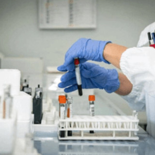 Cordoma del sacro, italiano il primo studio al mondo sull'efficacia dell'adroterapia Cordoma del sacro, italiano il primo studio al mondo sull'efficacia dell'adroterapia