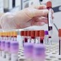 Sclerosi multipla recidivante, Ema raccomanda approvazione ocrelizumab dai 10 anni
