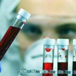 Leucemia linfatica cronica, con zanubrutinib sopravvivenza al 74% a 6 anni