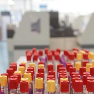 Malaria in aeroporto in Germania, gli esperti: "Campanello d'allarme, ma il rischio resta contenuto" Malaria in aeroporto in Germania, gli esperti: "Campanello d'allarme, ma il rischio resta contenuto"