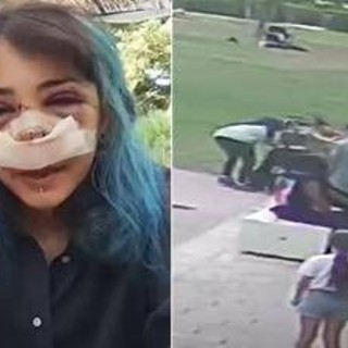 Picchiata al Parco Rossani, processo al via il 4 novembre: la 26enne ha pubblicato il video dell’aggressione Picchiata al Parco Rossani, processo al via il 4 novembre: la 26enne ha pubblicato il video dell’aggressione