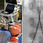 Incidente con un'acquasantiera in chiesa, bimba di 6 anni operata d'urgenza all'aorta a Bari Incidente con un'acquasantiera in chiesa, bimba di 6 anni operata d'urgenza all'aorta a Bari