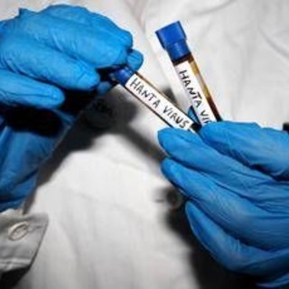 Hantavirus, l'Oms avverte: è più contagioso non appena compaiono i sintomi Hantavirus, l'Oms avverte: è più contagioso non appena compaiono i sintomi
